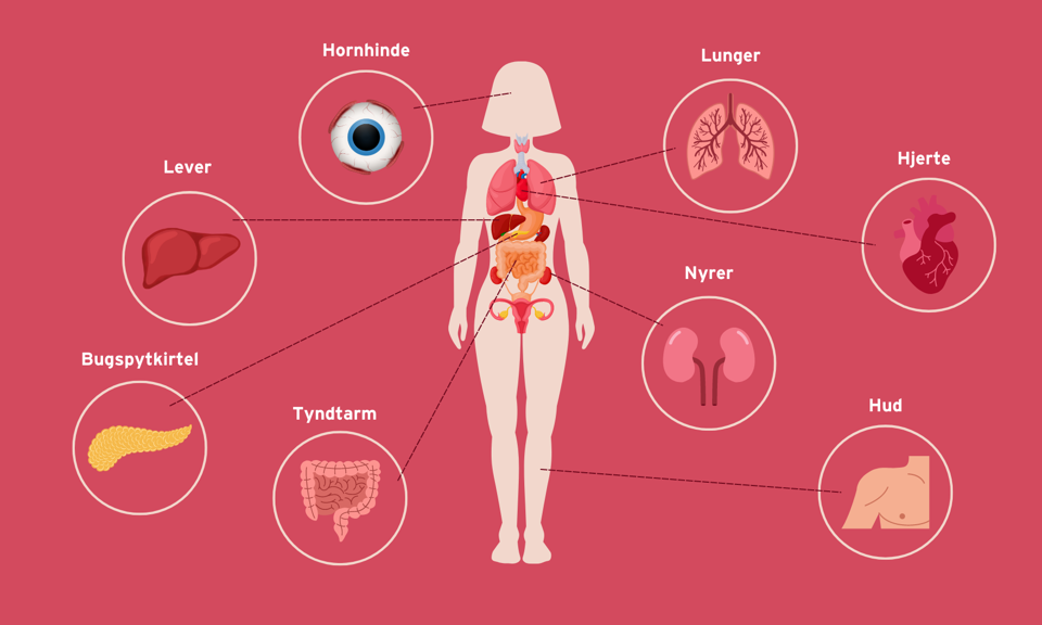 Grafik for organdonation